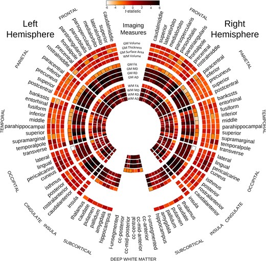 Group comparison of control subjects and MB patients. Group comparison of healthy control subjects and MB patients after controlling for age and ventricular volume for the 12 parameters assessed across brain regions. The colour bar demonstrates the mapping of the t-statistic from white (Negative 6) to black (Positive 6) through varying shades of orange. Each sector of the circle represents a different region. Each ring of the figure shows t-statistic for a different metric, as demonstrated at the 12 O’clock position of the figure. Specific GM and WM regions are outlined in black if the difference between control and MB groups is statistically significant (P < 0.05).
