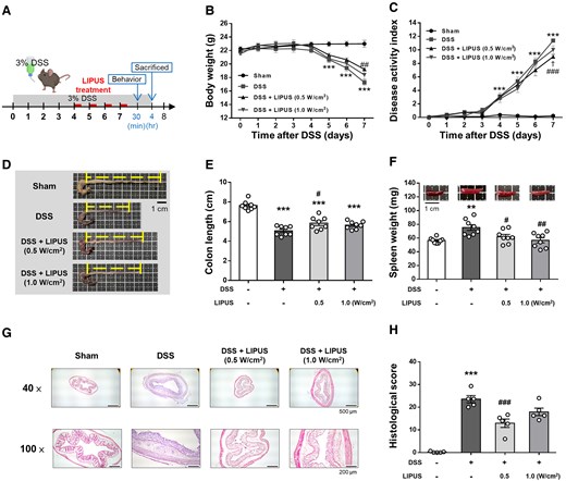 LIPUS alleviated colon damage in DSS-induced acute colitis. (A) Time schedule of the study. Mice were treated with 3% DSS dissolved in drinking water for 7 days. LIPUS treatment was administered to the brain daily from Days 4 to 7. (B) Changes in body weight in each group. (C) DAI score of each group (B and C, n = 8 for four groups). Representative photographs of colon (D) and colonic length measurement (E). (F) Effect of LIPUS treatment on spleen weight in DSS-induced acute colitis (E and F, n = 8 for four groups). Representative images of hematoxylin and eosin staining (G) and histological scores (H) (H, n = 5 for four groups). In (B) and (C), *, #, and † denote a significant difference between the DSS group and the Sham group, DSS + LIPUS 0.5 group, and DSS + LIPUS 1.0 group, respectively. In (E), (F) and (H), * and # denote significant differences from the Sham group and the DSS group, respectively (#,†, P < 0.05; **,##, P < 0.01; ***,###, P < 0.001). All data are shown as mean ± SEM. Dots represent the number of samples (studied animals). One-way ANOVA followed by Tukey’s post hoc test. DAI, disease activity index; DSS, dextran sulphate sodium; LIPUS, low-intensity pulsed ultrasound.