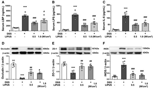 LIPUS attenuated intestinal barrier defects induced by DSS. Levels of (A) LPB, (B) LPS and (C) IL-6 in serum. The relative protein levels of (D) occludin, (E) ZO-1 and (F) iNOS in colon tissue. * and # denote significant differences from the Sham group, DSS group, and DSS + LIPUS 0.5 group, respectively (#, P < 0.05; ##, P < 0.01; ***,###, P < 0.001; n = 5). All data are shown as mean ± SEM. Dots represent the number of samples (studied animals). One-way ANOVA followed by Tukey’s post hoc test. See supplementary materials for uncropped blots. DSS, dextran sulphate sodium; IL-6, interleukin-6; iNOS, inducible nitric oxide synthase; LBP, LPS-binding protein; LIPUS, low-intensity pulsed ultrasound; LPS, lipopolysaccharide; ZO-1, zonula occludens-1.