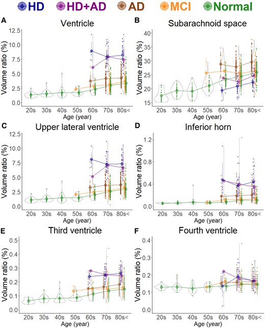 Segmented region volume ratio of cerebrospinal fluid spaces. Each graph has violin plots for the distribution of the segmented volume ratio and a circle with line graphs for the mean volume ratio in each decade stratified according to disease. Hakim’s disease (HD, N = 52), Alzheimer’s disease (AD, N = 256), HD with AD (HD + AD, N = 25), mild cognitive impairment (MCI, N = 163), and normal volunteers (N = 474). (A) Ventricle; (B) Subarachnoid space; (C) Upper part of lateral ventricle; (D) Inferior horn of lateral ventricle; (E) Third ventricle; and (F) Fourth ventricle.