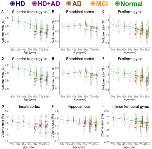 Segmented region volume ratio of specific brain subregions. Each graph has violin plots for the distribution of the segmented volume ratio and a circle with line graphs for the mean volume ratio in each decade stratified according to disease. Hakim’s disease (HD, N = 52), Alzheimer’s disease (AD, N = 256), HD with AD (HD + AD , N = 25), mild cognitive impairment (MCI, N = 163), and normal volunteers (N = 474). (A) Supramarginal gyrus; (B) Pars triangularis; (C) Paracentral gyrus; (D) Superior frontal gyrus; (E) Entorhinal cortex; (F) Fusiform gyrus; (G) Insula cortex; (H) Hippocampus; and (I) Inferior temporal gyrus.
