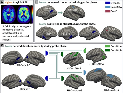 Amyloid-associated changes in working-memory retrieval connectivity.