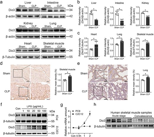 Dio3 expression increased mainly in skeletal muscles and lung tissues upon early sepsis. (a) Representative immunoblots of Dio3 expression in primary peripheral tissues, including the liver, intestine, kidney, heart, lung, and skeletal muscles, of control rats or rats subjected to CLP modelling (n = 6). (b, c) Quantitative analysis of (a). (d) Representative images of Dio3 IHC staining in skeletal muscles of rats with or without CLP modelling and their quantification (n = 6; scale bar: 50 μm&100 μm). (e) Representative images of Dio3 IHC staining in lung tissues of rats with or without CLP modelling and their quantification (n = 6; scale bar: 50 μm&100 μm). (f) Immunoblotting demonstrating the expression of Dio3 in PC9 and C2C12 cells exposed to gradient LPS concentrations for 24 h (0, 1, 10, 20, 50, and 100 μg/ml; n = 3). (g) Quantitative RT-PCR analysis of Dio3 mRNA expression in PC9 and C2C12 cells treated with 100 μg/ml LPS (n = 3). (h) Immunoblotting demonstrating the expression of Dio3 in human skeletal muscle biopsy samples (acute stage, biopsy taken within 1 week of admission; convalescence, biopsy taken shortly before discharge during the convalescent stage). *P < 0.05; NS, not significant. Two-tailed Student’s unpaired t-test and Mann–Whitney test for (b, c) or two-tailed Student’s unpaired t-test for (d, e and g). Quantitative data are represented as mean ± SD. NS not significant, Dio3 type 3 deiodinase, CLP cecal ligation and puncture, LPS lipopolysaccharide, IHC immunohistochemistry