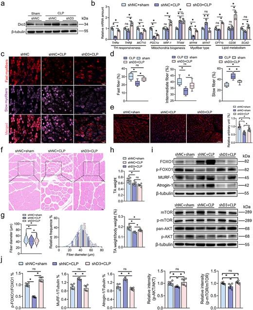 Targeted inhibition of Dio3 ameliorates sepsis-induced metabolic disruption in skeletal muscles. (a) Representative immunoblots of Dio3 in the TA of rats belonging to the shNC + sham, shNC + CLP, and shD3 + CLP groups (n = 6). (b) Quantitative RT-PCR analysis of T3-responsive genes in samples in the same setting as in (a; n = 3). (c) Representative images of IF staining of MYH7 and MYH4 in TA (scale bar: 50 μm) of rats in the same setting as in (a; n = 6). (d) Quantitative analysis of fiber proportion in (c) by ImageJ. (e) Representative images of the IF staining of Glut4 in TA (scale bar: 100 μm) of rats in the same setting as in (a) and their quantification (n = 6). (f) Representative images of the HE staining of skeletal muscles in the same setting as in (a; n = 6; scale bar: 20 μm&50 μm). (g) Quantitative analysis of the fiber diameters in (f) by ImageJ. (h) Weight of TA and its proportion to body weight (n = 6). (i) Representative immunoblots of the expression of catabolic hallmarks (FOXO1, p-FOXO1, MuRF1, and ATROGIN1) and anabolic hallmarks (mTOR, p-mTOR, AKT, and p-AKT) in the skeletal muscle tissues of rats in the same setting as in (a; n = 6). (j) Quantification analysis of immunoblots in (i; n = 6). *P < 0.05. Two-tailed Student’s unpaired t-test and Mann–Whitney test for (g, j) or one-way ANOVA followed by Tukey’s multiple comparisons tests for (b, d, e, h, and j). Quantitative data are represented as mean ± SD. NS not significant, Dio3 type 3 deiodinase, CLP cecal ligation and puncture, LPS lipopolysaccharide, THR thyroid hormone receptor, MCT10 solute carrier family 16 member 10, PGC1α peroxisome proliferator-activated receptor gamma coactivator 1α, NRF1 nuclear respiratory factor 1, TFAM transcription factor a mitochondrial, MYH myosin heavy chain, CPT1b carnitine Palmitoyltransferase 1B, SCAD short chain acyl-CoA dehydrogenase, TA tibialis anterior, FOXO1 Forkhead box O1, MURF-1 muscle-specific RING finger protein 1, Atrogin1 muscle atrophy F-box protein, mTOR mechanistic target of rapamycin kinase, AKT protein kinase B