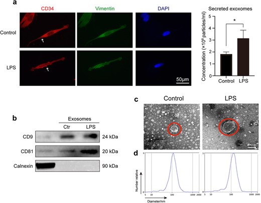 LPS-induced secretion of active TC exosomes may play a vital role on LPS-mediated EC injury. (a) Active TC exosomes are secreted from the intracellular to the extracellular area. The expulsion and volume of TC exosomes increased following LPS stimulation. White arrows indicate TC exosomes. (b) Western blot analysis was performed to identify TC exosomes by detecting proteins CD9, CD81, and Calnexin. (c) Transmission electron micrographs show that the diameter of active TC exosomes increased after stimulation of LPS. (d) Nanoparticle tracking analysis (NTA) was used to analyze the sizes of TC exosomes. *P < .05. LPS, lipopolysaccharide; ctr, control