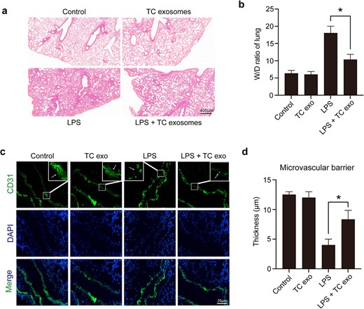 LPS-activated TC exosomes alleviated acute lung injury under septic conditions. (a, b) Assessing the general changes in mice lungs under different conditions by hematoxylin and eosin. LPS causes lung endothelial barrier disruption, inflammatory cell infiltration, and lung edema, which were obviously alleviated by LPS-activated TC exosomes (magnification, ×200). (c, d) Evaluating the changes in microvasculature by positive staining for CD31 (green) in lung tissue under different conditions. The lung microvascular barrier was seriously disrupted by LPS, but the vascular damage was reversed by LPS-induced active TC exosomes (magnification, ×400). *P < .05. TC, telocyte; LPS, lipopolysaccharide; TC exo, telocyte exosomes; W/D, wet/dry
