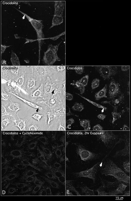 Distribution of the external domain of the EGFR protein in RPM cells exposed to crocidolite asbestos for 8 h as indicated by the arrows in the top panels (A). The middle panels show both phase microscopy (B) and immunofluorescence (C), illustrating the fusiform shape of cells encompassing long crocidolite fibres and expressing intense patterns of EGFR protein. Cells exposed to a number of shorter fibres remain polygonal with no increase in EGFR protein expression. The bottom panels show inhibition of crocidolite-mediated EGFR protein with cycloheximde at 8 h (D) and no increase in EGFR protein after 2 h exposure to crocidolite (E).
