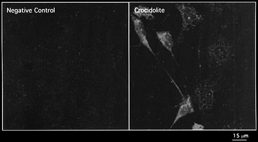 Expression of the phosphorylated form of the EGFR protein in RPM treated with crocidolite for 8 h as shown by immunofluorescence detected by CLSM.