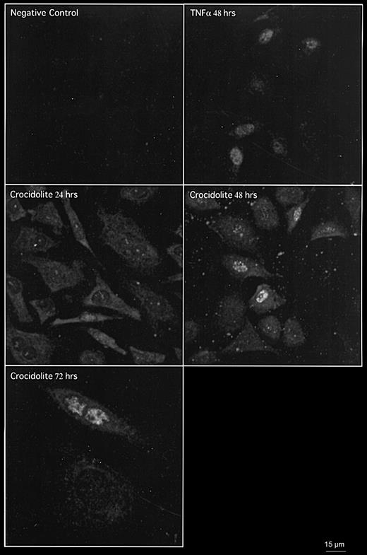 Crocidolite induces EGFR expression at 24, 48 and 72 h and PCNA expression at 48 and 72 h in RPM cells as shown by co-immunofluorescence detected by CLSM. TNFα was used as a positive control for PCNA expression in RPM cells at 48 h.