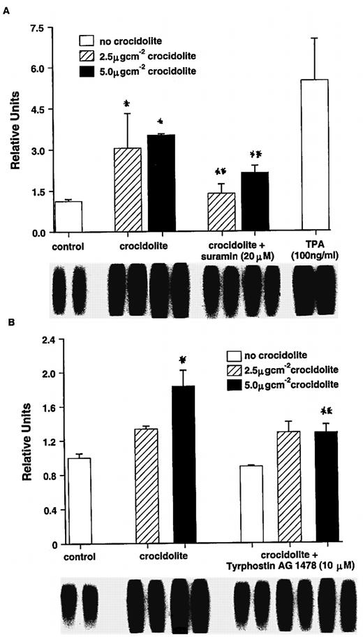 Effect of suramin (A) and the EGFR inhibitor tyrphostin AG 1478 (B) on crocidolite-mediated AP-1–DNA binding activity in RPM cells: *Significantly different from untreated controls (P < 0.05): **Significantly different from crocidolite alone (P < 0.05).