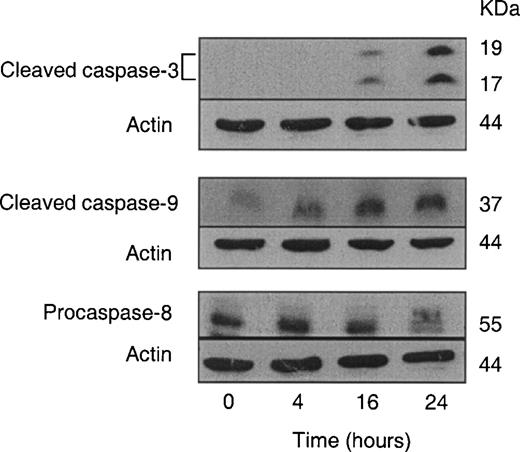 Western blot analysis for cleaved caspase-3, cleaved caspase-9 and procaspase-8 using lysates from PC-3 cells exposed to 20 µM SFN for specified time intervals. Equal amounts of lysate protein (80 µg for cleaved caspase-3, and 60 µg for cleaved caspase-9 and procaspase-8) were subjected to gel electrophoresis. Data are representative of at least two independent experiments with similar results.
