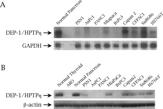  ( A ) DEP-1/HPTPη gene expression assessed by northern blot analysis on normal pancreas and pancreatic cancer cell lines. GAPDH was used as a control for RNA loading. ( B ) DEP-1/HPTPη protein expression assessed on normal pancreatic tissue and pancreatic malignant cells by western blot with an anti-r-PTPη antibody. β-Actin is to demonstrate an equal protein loading. 