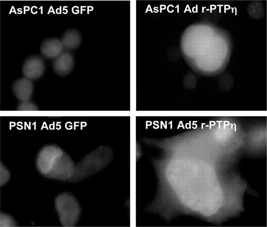  Fluorescent micrograph (original magnification, ×100) showing the morphology of AsPC1 and PSN1 pancreatic cells infected with Ad GFP (left panels) and Ad r-PTPη (right panels) 24 h after infection at MOI 50. Counterstaining with Hoechst dye was used to facilitate nuclei localization. See online supplementary material for a colour version of this figure. 