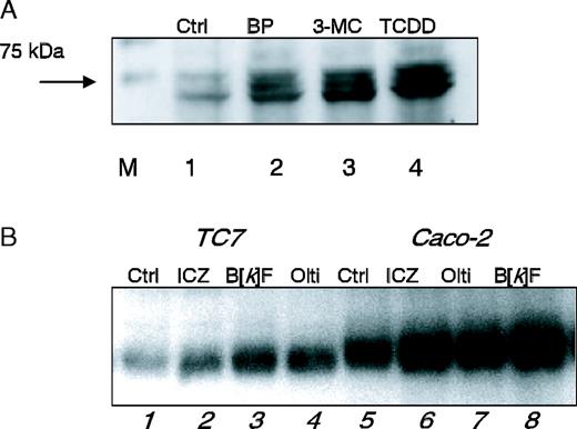  ( A ) Western blot analysis of BCRP in Caco-2 cells after 3 days of treatment with vehicle (0.1% DMSO, lane 1), BP (10 μM, lane 2), 3-MC (5 μM, lane 3), TCDD (50 nM, lane 4). (The arrow indicates 75 kDa protein of the standard; M = marker.) Whole cell lysates were prepared, and 75 μg of protein were resolved by SDS–PAGE (10% acrylamide) and blotted as described in the ‘Materials and methods’ section. One representative of three similar experiments is shown. ( B ) Western blot analysis of BCRP in Caco-2 cells and its subclone TC7. TC7 cells were treated for 3 days with either vehicle (0.1% DMSO, lane 1), ICZ (5 μM, lane 2), B[ k ]F (5 μM, lane 3) or oltipraz (50 μM, lane 4). Caco-2 cells were treated for 3 days with either (0.1% DMSO, lane 5), ICZ (5 μM, lane 6), oltipraz (50 μM, lane 7) or B[ k ]F (5 μM, lane 8). Proteins (75 μg) from whole cell lysates were loaded onto an 8% acrylamide gel and separated by SDS–PAGE as described in the ‘Materials and methods’ section. One representative of three similar experiments is shown. 