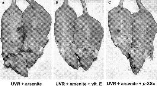  Representative skin tumor distributions in mice treated with ( A ) UVR + arsenite, ( B ) UVR + arsenite + vitamin E and ( C ) UVR + arsenite + p -XSC. Hairless mice were subjected to UVR plus arsenite exposure with or without vitamin E or organoselenium p -XSC in the diet, as described in Materials and methods. The photograph was taken after 26 weeks of UVR exposure. See online Supplementary material for a color version of this figure. 