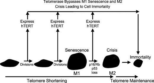  The ectopic expression of the catalytic subunit of hTERT results in immortalization of human cells if telomeres are rate-limiting for continued cell proliferation. Telomeres are thus important in both senescence (M1) and crisis (M2) as hTERT introduction either before M1 or after M1 results in cell immortalization. If the introduction of hTERT does not result in immortalization this reflects another type of growth arrest that is telomere-independent and is likely to reflect inadequate culture conditions leading to STASIS or what has been termed premature senescence or culture shock. 