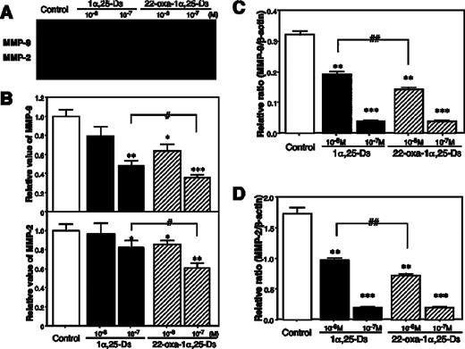  Effects of 1α,25-D 3 and 22-oxa-1α,25-D 3 on MMP-2 and MMP-9 mRNA expression and secretion levels in LLC-GFP cells. ( A ) MMP-9 mRNA, ( B ) MMP-2 mRNA, ( C ) zymographic assay with conditioned medium of LLC-GFP cells treated with control, 1α,25-D 3 or 22-oxa-1α,25-D 3 . ( D ) Relative ratio of MMP-2 and MMP-9 activity by gelatin zymography. Each bar represents the mean ± SE. *,#P < 0.05, **,##P < 0.01 and ***P < 0.001 ( n = 6). 