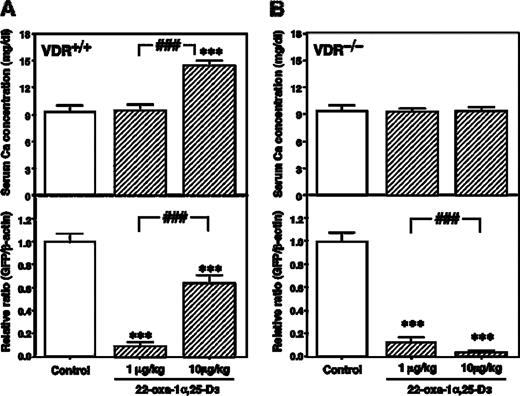  Effects of continuous treatment with 22-oxa-1α,25-D 3 on the development of lung metastases in LLC-GFP cell-injected VDR+/+ mice and VDR−/− mice fed a high calcium and vitamin D-deficient diet. 22-Oxa-1α,25-D 3 (1 or 10 µg/kg/day) or vehicle was infused continuously by an osmotic minipump implanted s.c. on the same day as the LLC-GFP cell injection. Serum and lungs were collected on day 18 after the cell injection. ( A ) Serum calcium concentration and GFP mRNA expression of the lung in LLC-GFP cell injected VDR+/+ mice. ( B ) Serum calcium concentration and GFP mRNA expression of the lung in LLC-GFP cell injected VDR−/− mice. Each bar represents the mean ± SE ( n = 10). ***P < 0.001, significant difference from vehicle treated animals. ###P < 0.001, significant difference from 22-oxa-1α,25-D 3 (1 µg/kg/day) treated animals. 