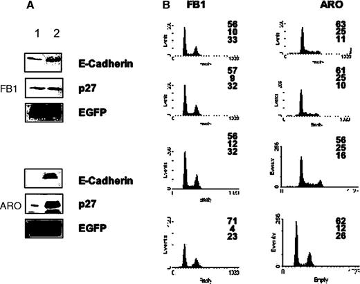  Expression of E-cadherin induces growth arrest and increases p27 kip1 expression in thyroid carcinoma cells. ( A ) Expression of and p27 kip1 in E-cadherin-transfected FB1, ARO cells. Cells (1–3 × 10 6 cells/10 cm dish) were cotransfected with 3 µg of p27 kip1 and 6 µg of pIRES-E-cadherin (lane 2). Twenty-four hours after the transfection, cells were lysed in extraction buffer and the expressed E-cadherin or p27 kip1 were detected by immunoblotting. Controls represent mock transfections using pIRES vector (lane 1). ( B ) Cells (1–3 × 10 6 cells/10 cm dish) were cotransfected with 5 µg of pfEGFP and 10 µg of pIRES vectors expressing E-cadherin. Twenty-four hours after the transfection, cells were harvested and processed for flow cytometry analysis. Left column: cells transfected with pfEGFP and control pIRES vector. Middle column: cells transfected with pfEGFP and pIRES-E-cadherin; cell cycle profile is relative to cells sorted for being negative for fEGFP (and E-cadherin). Right column: cells transfected with fEGFP and E-cadherin; cell cycle profile is relative to cells sorted for being positive for fEGFP (and E-cadherin). 