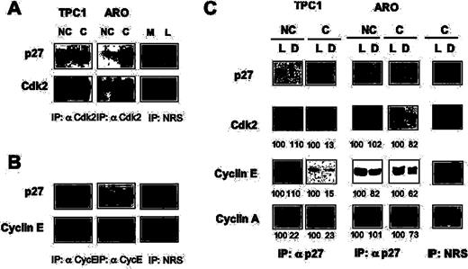  Analysis of cyclin/Cdk complexes in contact-inhibited thyroid cancer cells. Eight hundred micrograms of total protein extracts were immunoprecipitated with antibodies to Cdk2 ( A ), cyclin E ( B ) or with normal rabbit serum (NRS), as indicated, and analysed by immunoblot to determine the amount of associated p27 kip1 . All immunoprecipitates were normalized against the levels of the immunoprecipitated proteins. L, lysate. M, mock. ( C ) Lysates from non-confluent (NC) or confluent (C) TPC-1 and ARO cells were depleted with anti-p27 kip1 antibody or with a rabbit anti-mouse antibody for mock depletion (Mock). Following three sequential rounds of immunoprecipitation, we probed the lysates (L) or the supernatants (D) with antibodies specific to p27 kip1 , Cdk2, cyclin E and cyclin A, as indicated. Lysates and supernatants are indicated at the top of the figure. Bands were quantified and the values of the different proteins found in the supernatants were expressed as a percentage of the control value set at 100% in the lysates before p27 kip1 immunodepletion. 