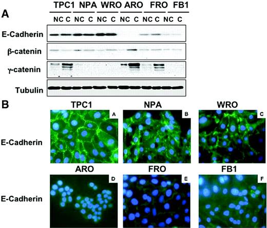  Expression of E-cadherin and β-catenin in thyroid cancer cells. ( A ) Western blot analysis of E-cadherin, β-catenin and γ-catenin in non-confluent (NC) or confluent (C) thyroid carcinoma cells. β-Tubulin served for normalization of protein loaded. ( B ) Analysis of E-cadherin subcellular distribution in thyroid cancer cells by immunofluorescence. A strong membrane signal is observed in TPC-1, NPA and WRO cells. A weak membrane expression of E-cadherin is observed in ARO, FRO and FB-1 cells; altered distribution of cadherin/catenin molecules characterized by irregular staining of regions of cell–cell contacts is observed in FRO cells. 