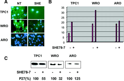  Disruption of E-cadherin-mediated cell–cell contacts overcomes confluence-induced growth arrest and decreases p27 kip1 expression. To disrupt E-cadherin-mediated cell–cell contacts at confluence, TPC-1, WRO and ARO cells were plated onto glass coverslips, in complete medium, in the presence of 2 µg/ml of SHE78-7 anti E-cadherin antibody for 48 h, and then the cells were incubated with 10 µM BrdU for 2 h and processed for indirect immunofluorescence or western blot. ( A ) Treatment of TPC-1, NPA cells with SHE78-7 anti-E-cadherin antibody abrogates the strong membrane signal of E-cadherin. ( B ) The graphs indicate the percentage of BrdU positive cells. ( C ) Western blot analysis of p27 kip1 levels in the presence or absence of SHE78-7 anti-E-cadherin antibody. Reduction of p27 kip1 expression induced by SHE78-7 antibody is expressed as a percentage and indicated under the blots. 