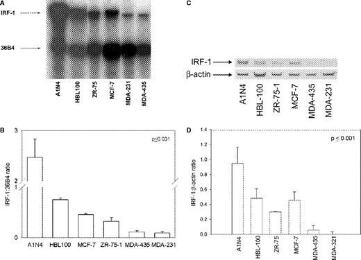  IRF-1 expression in five human breast cancer and one normal breast cell lines. (A) Representative RNase protection assay. (B) RNase protection analyses of IRF-1 mRNA; data represent mean ± SE of three independent determinations, where absorbance is expressed as a ratio of IRF-1:36 B4; P ≤ 0.001 (one-way ANOVA). ( C ) Representative immunoblot of IRF-1 protein; β-actin = loading control. ( D ) Immunoblot analyses of IRF-1 protein; data represent mean ± SE of three independent determinations, where densitometry values are expressed as a ratio of IRF-1:β-actin; P ≤ 0.001 (one-way ANOVA). 