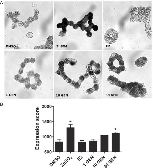  Immunocytochemical analysis of metallothionein protein expression levels after 12 h incubation with various compounds. LAPC-4 cells were incubated with 0.1 % DMSO, 50 μM zinc sulphate (ZnSO 4 ), 0.3 μM 17β-estradiol (E2) or 1–30 μM genistein (GEN) for 12 h. Monochrome images show representative cells, stained following the procedure described in the Materials and methods section. Blackening of cells is indicating the presence of metallothionein protein and appeared orange under the microscope. For each sample, 500 cells were manually evaluated and allocated to three classes according to the intensity of staining. An arbitrary expression score was defined to compare the level of metallothioneins (see the Materials and methods section). Treatment with 50 μM ZnSO 4 and 30 μM genistein significantly increased the expression score from 830 (DMSO) to 1299 and 1118, respectively. Values are means ± SEM of the arbitrary expression score. *P < 0.05, compared to the vehicle control DMSO (one-way ANOVA, Dunnett's post-test, n = 3). 
