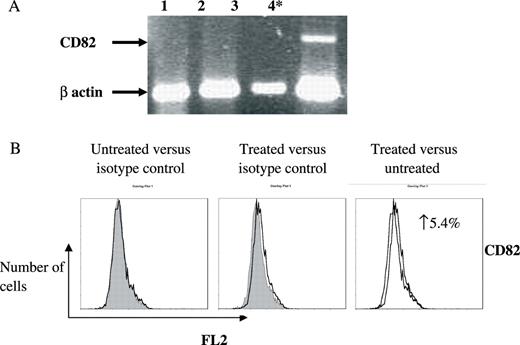  Combined de-methylation and HDAC inhibition induces synergistic re-expression of CD82 transcript in CAG. CAG cells were treated with solvent (lane 1); 5-aza-dc (lane 2); TsA (lane 3); and combined 5-aza-dc TsA (lane 4). The experiment was executed four separate times. ( A ) A representative gel electrophoresis of RT–PCR products. Arrows denote the CD82 transcript and the internal β actin control transcript. Statistically significant differences are indicated (asterisk). ( B ) Membranal expression of CD82 with and without combined 5-aza-dc and TsA treatment was assessed by flow cytometry employing monoclonal antibody and matching isotype. Three separate experiments were conducted and the FACS recorded 10 000 events. These representative histograms depict the number of cells ( y -axis) versus FL2 fluorescence ( x -axis). An elevation of CD82 expression in the treated cells is indicated as increase of expressing cells (%). 