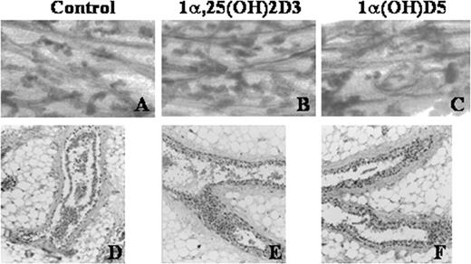  Mouse mammary glands from Balb/c mice were incubated with growth promoting hormones in serum-free medium for 6 days with or without 1α(OH)D5. ( A – C ), Whole mounts of the glands were stained with carmine and analyzed for alveolar growth. ( D – F ), Glands were fixed, paraffin embedded, and stained with hematoxylin and eosin to observe the ductal growth. ( A ) and ( D ), Control; ( B ) and ( E ) 1α,25(OH) 2 D 3 (0.1 μM); and ( C ) and ( F ) 1α(OH)D5 (1 μM). 