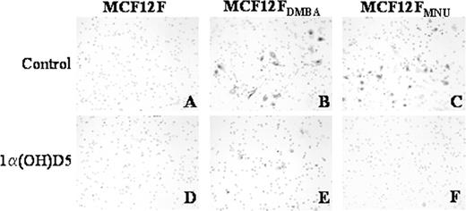  Comparison of the effect of 1α(OH)D5 (1 μM) on the invasive potential of MCF-12F, MCF-12F DMBA and MCF-12F MNU cells. Matrigel ® coated membrane in Boyden chambers were stained 48 h after 1α(OH)D5 treatment. ( A ) and ( D ), MCF-12F control and 1α(OH)D5; ( B ) and ( E ), MCF-12F DMBA control and 1α(OH)D5; ( C ) and ( F ), MCF-12F MNU control and 1α(OH)D5, respectively. 