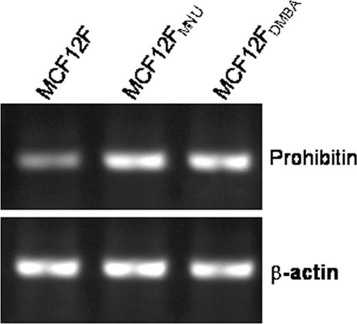 RT–PCR analysis of steady state levels of prohibitin mRNA in normal and transformed MCF-12F cells. Prohibitin expression was 2-fold higher in the transformed cells as compared with the parent MCF-12F cells.