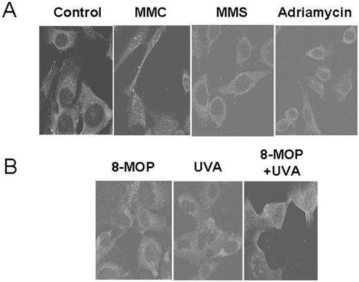  Formation of the ssDNA foci was observed following treatment with MMC, not with ADR or MMS. ( A ) Following BrdU labeling of cells for 30 h, WT human fibroblast cells were treated with various DNA damaging agents (2 µM MMC, 100 µM MMS or 10 µM ADR) for 1 h. Cells were further incubated in fresh media for 24 h prior to cell fixing and immunostaining with an anti-BrdU antibody specific for ssDNA patches. Fluorescence images were analyzed by confocal microscope. ( B ) WT cells were treated with 8-MOP (100 µM), UV-A (500 J/m 2 ), or both 8-MOP + UV-A prior to immunostaining analysis using an anti-BrdU antibody specific for ssDNA patches. 