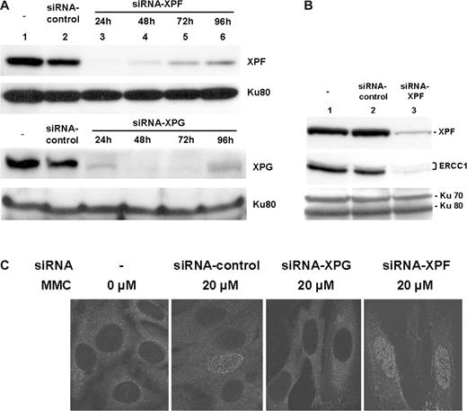  A targeted inhibition of XPG abolished formation of the ssDNA foci following MMC treatment. ( A ) Effect of XPG- or XPF-specific siRNA on protein expression. WT human fibroblast cells were either untreated (lane 1; upper & lower panels), or treated with a control (scrambled) siRNA (lane 2; upper and lower panels), XPF-specific siRNA (lanes 3–6; upper panel) or XPG-specific siRNA (lanes 3–6; lower panel). After harvesting cells at various times, expression of XPG or XPF was analyzed by immunoblot. Expression of Ku80 was included as an internal control for individual lanes. ( B ) A targeted inhibition of XPF also affected expression of its binding partner, ERCC-1. WT human fibroblast cells were either untreated (lane 1), or treated with a control (scrambled) siRNA (lane 2), or XPF-specific siRNA (lane 3) for 48 h prior to harvest. Cell extracts were prepared and analyzed for XPF and ERCC1 by western blot. Expression of Ku70/Ku80 was included as an internal control (bottom panel). ( C ) A siRNA targeting of XPG not XPF abolished formation of the ssDNA foci following MMC treatment. WT human fibroblast cells were treated with indicated siRNA for 24 h prior to treatment with 20 µM MMC for 1 h. Following incubation for 24 h, the ssDNA foci were visualized using immunofluorescence with an anti-BrdU antibody specific for ssDNA patches. Cells were analyzed by confocal microscope. 