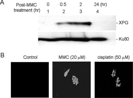  Chromatin association of XPG was induced upon MMC damages. ( A ) Western blot analysis of chromatin-associated XPG following MMC damage. HeLa cells were treated with MMC (20 µM) for 1 h and harvested at various time points. Isolated nuclei were washed with a buffer containing 0.3 M NaCl, and chromatin-associated proteins were separated on 8% SDS–PAGE and analyzed for XPG by western blot. Ku80 was used for western analysis as a loading control. ( B ) Immunofluorescence analysis of chromatin-associated XPG following treatment with either MMC or cisplatin. HeLa cells were grown on slides and treated with nothing (first row), 20 µM MMC (middle row) and 50 µM cisplatin (third row) for 1 h and incubated for 2 h prior to chromatin preparation. Images were collected using a Zeiss LSM-510 confocal microscope. 