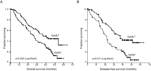  Kaplan–Meier plots of EphB2 expression in association with overall survival ( A ) and disease-free survival ( B ) in CRCs. 