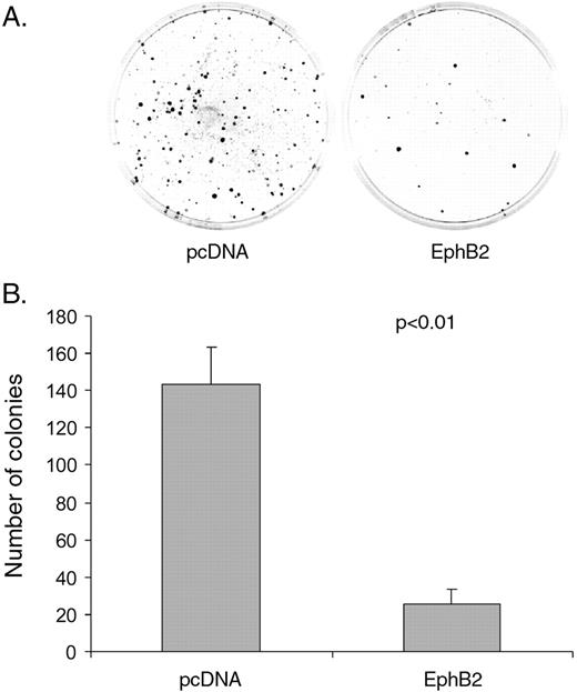  Over-expression of EphB2 inhibits colony formation in SW480 cells. ( A ) Representative images of colony formation in stably transfected SW480/EphB2 or EphB2/pcDNA3 cells. ( B ) Average number of colonies of SW480/EphB2 or EphB2/pcDNA3 cells. Values represent mean from triplicate wells, ±S.D. 