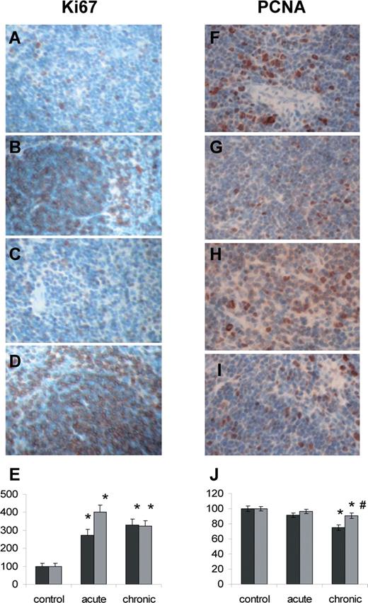  Radiation-induced changes in the cellular proliferation levels monitored by Ki67 (A–E) and PCNA (F–J) immunohistochemistry. ( A ) Control male; ( B ) chronically exposed male; ( C ) control female; ( D ) chronically exposed female; ( E ) Ki67 proliferation index in control and exposed male an female spleen; data are shown as the mean ± SEM; * P < 0.05, Student's t -test, as compared to control; ( F ) control male; ( G ) chronically exposed male; ( H ) control female; ( I ) chronically exposed female; ( J ) PCNA index in control and exposed male and female spleen; data are shown as the mean ± SEM; * P < 0.05, Student's t -test, as compared to control; #P < 0.05, Student's t -test, as compared to males. Black bars–males, grey bars–females. 