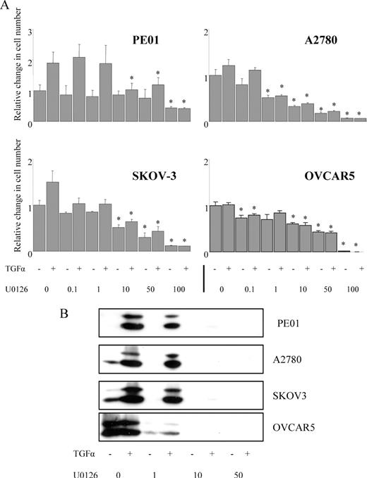  TGFα-stimulated phosphorylation of MEK and ERK in the panel of ovarian cancer cell lines and their inhibition by UO126. ( A ) Four cell lines (PEO1, A2780, SKOV-3 and OVCAR-5) were grown in reduced media conditions and treated with UO126 (0–100 μM) in the presence or absence of TGFα (1 nM) for 5 days. Cellular proliferation was determined by cell counter and expressed relative to untreated control cells. Thus samples where growth in the presence of the inhibitor was statistically different from that in its absence are shown ( *P < 0.05). Results represent the mean ± SE of two experiments. ( B ) Western blots of TGFα-induced phosphorylation of ERK in the presence or absence of UO126 are shown for the four cell lines shown above. Cells were treated with UO126 (0–50 μM) for 5 min prior to the addition of media with or without TGFα (1 nM) for 15 min at 37°C. Activity was determined by immunoblotting with antibodies specific for phosphorylated ERK 1/2. Total ERK levels were unchanged (data not shown). Results shown are representative of two experiments. 