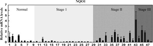 The Nrf2-dependent defense response is upregulated in lung tumors and cancer cell lines. cDNAs from human lung tissues of normal and various stages of cancers were subjected to real-time reverse transcription–PCR for detection of NQO1 mRNA expression. The same set of samples in another plate was used for detection of GAPDH. The data represent relative mRNA levels of NQO1 normalized to GAPDH. The experiment was conducted three times and the standard deviation was shown.