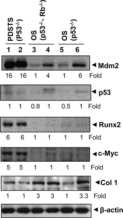  Analysis of gene products in tumor specimens. Western blot analysis showed expressions of Mdm2, p53, Runx2, c-Myc and Col1a1 in various tumor specimens. Lanes 1–2, PDSTS from two different mice with the genotype Prx1-cre p53 lox/lox ; lanes 3–4, OS from two different mice with the genotype Prx1-cre p53 lox/lox Rb lox/lox and lanes 5–6, OS from two different mice with the genotype Col1a1-cre p53 lox/lox . Values under the blot indicate the fold changes. 