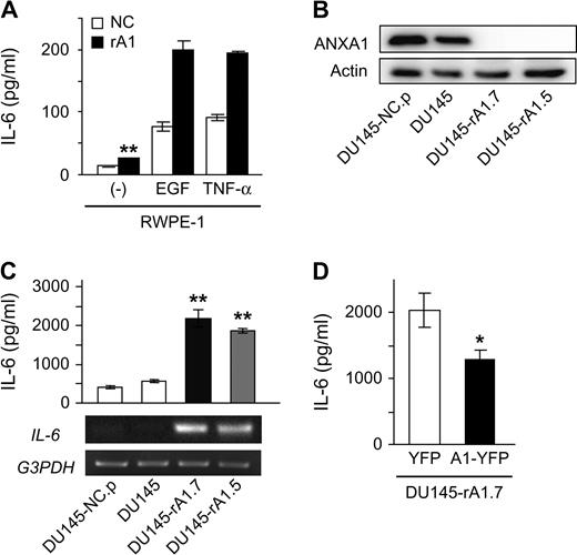  ANXA1 regulates IL-6 expression in prostatic epithelial cells. ( A , C and D ) Secreted IL-6 levels were measured from culture supernatants of RWPE-1/NC and RWPE-1/rA1 cells by enzyme-linked immunosorbent assay and data represent the mean ± SD. (graphs). ( A ) IL-6 secretion was measured from unstimulated RWPE-1/NC and rA1 cells (−) or cells stimulated with 25 ng/ml EGF or 10 ng/ml TNF-α. Unstimulated IL-6 secretion from RWPE-1/rA1 was significantly different from unstimulated RWPE-1/NC by a Student's t -test, ** P  = 0.0016. ( B ) Reduction of ANXA1 protein expression in DU145-expressing ANXA1 shRNA and controls was measured by western blotting. ( C ) IL-6 secretion from DU145 variants was determined by enzyme-linked immunosorbent assay (top) and IL-6 mRNA was estimated by semiquantitative reverse transcription (RT)–PCR (bottom). Double asterisks indicate significant difference from control DU145 cells as determined by Tukey–Kramer multiple comparison test ( P  < 0.001). ( D ) Restoration of ANXA1 protein expression suppresses IL-6 secretion. DU145-rA1.7 cells were transiently transfected with yellow fluorescent protein (YFP) or shRNA-insensitive ANXA1-YFP (srA1) expression plasmids and secreted IL-6 levels were measured after 24 h in culture. 