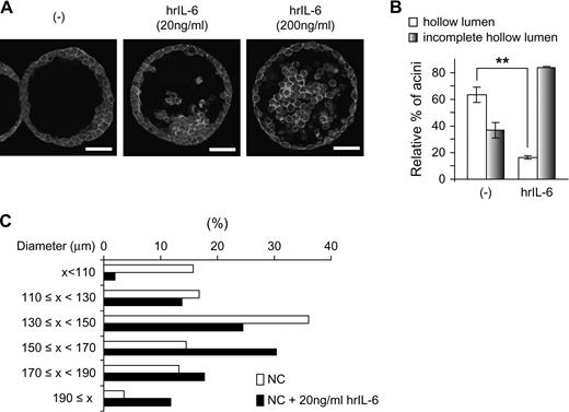  Effects of exogenous IL-6 on morphology of control RWPE-1 cells in 3D culture. ( A ) RWPE-1/NC cells were cultured in 3D with or without the indicated amounts of human recombinant (hr) IL-6 for 9 days, fixed, stained with 4′,6-diamidino-2-phenylindole (blue) to detect nuclei and rhodamine–phalloidin (red) to detect filamentous actin. Cells were visualized using confocal fluorescence microscopy. Bar, 50 μm. ( B and C ) Hollow lumen formation and acinar diameters of RWPE-1/NC cells cultured in 3D in the absence or presence of 20 ng/ml IL-6 were determined as in Figure 2 . The data are presented as mean percentage ± SD of total structures counted. Student's t -test, ** P < 0.01. The color version of this figure is available at Carcinogenesis Online. 