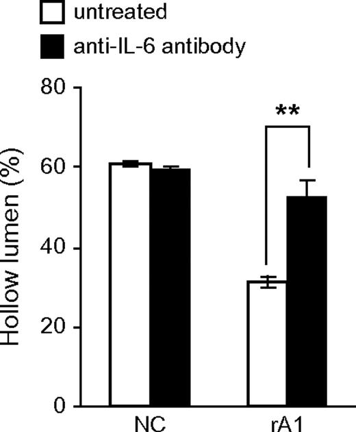  Blocking IL-6 bioactivity restores luminal clearing. RWPE-1/NC and rA1 cells were cultured in 3D in the presence or absence of 1 μg/ml anti-IL-6 antibody for 9 days and hollow lumen formation was quantified as before. Mean percentages ± SD of total structures counted are shown. Student's t -test, ** P < 0.01. 