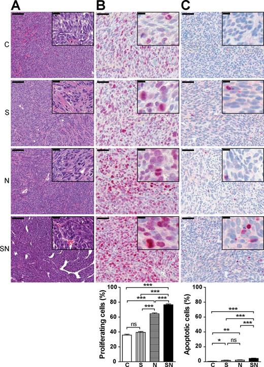  Survivin enhances MYCN-induced tumor growth by increasing the proliferation-to-apoptosis ratio. Paraffin-embedded tissue sections were analyzed for morphology, proliferation (Ki-67) and apoptosis (CC3) using immunohistochemistry. At least, 800 nuclei per tumor section were counted. The means ± SEM are shown. Statistical analyses were done using ANOVA followed by Tukey’s Multiple Comparison Test. *** P < 0.001; ** P < 0.01; * P < 0.05; ns, not significant. ( A ) Anaplastic features are most pronounced in SN tumors. Representative hematoxylin and eosin staining (scale bar: 100 µm. Inset, scale bar: 20 µm). ( B ) Tumors that overexpress both transgenes show markedly increased proliferation. Representative staining for Ki-67 (scale bar: 50 µm; inset, scale bar: 10 µm) and its quantification. ( C ) SN tumors display a slightly increased apoptosis rate. Representative staining for CC3 (scale bar: 50 µm; inset, scale bar: 10 µm) and its quantification. 