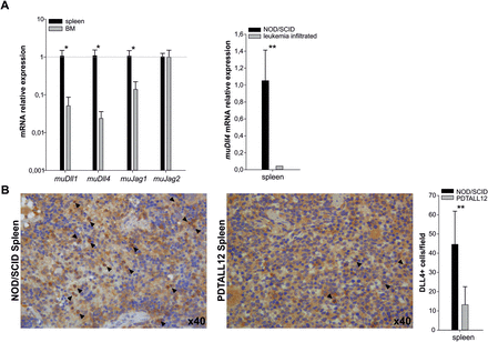 Expression of NOTCH ligands in the tumor microenvironment. (A). Measurement of murine (mu) Dll1, Dll4, Jag1 and Jag2 expression by qPCR analysis in BM and spleen of NOD/SCID mice. Murine β-actin was used as housekeeping gene. Left panel: Expression levels of each ligand in the BM were normalized to their expression in the spleen (mean ± SD of n = 4 samples). Right panel: Expression levels of muDll4 transcript in the spleen of PDTALL xenografts compared to healthy spleen (mean ± SD of n = 4 samples). (B) IHC analysis of DLL4 expression in spleen of a NOD/SCID healthy mouse (left) and of a mouse xenografted with PDTALL12 leukemia cells (middle) using a rabbit anti-DLL4 polyclonal antibody from Abcam (ab7280). Two representative high magnification (×40) images are reported. Positive cells are indicated by arrowheads. The histogram represents mean ± SD values of DLL4+ cells in the spleen of mice; quantitative analysis was performed at magnification ×20 by scoring n = 10 representative fields, n = 3 samples per group. Statistically significant differences are indicated (*P < 0.05, **P < 0.001).