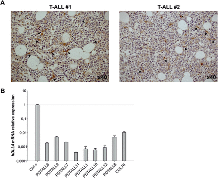 DLL4 expression in human T-ALL samples. (A) Evaluation of DLL4 expression by IHC in human BM samples from two T-ALL patients. Positive cells are indicated by arrowheads. (B) Quantitative real-time-PCR analysis of human DLL4 transcript in T-ALL xenografts. Human umbilical vein endothelial cells (HUVEC) were used as positive controls (Ctrl+) and human β2-microglobulin was used as housekeeping gene. Expression levels were normalized to Ctrl+.