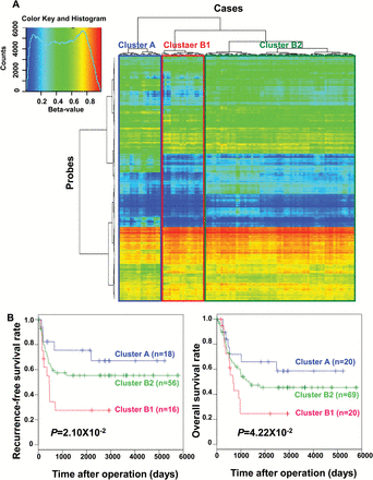Epigenetic clustering of gastric carcinomas based on DNA methylation profiles in non-cancerous gastric mucosae (N). (A) Unsupervised hierarchical clustering (Euclidean distance, Ward’s method) using DNA methylation levels in N samples (βN) for the 3861 probes listed in Supplementary Table 4 (available at Carcinogenesis Online). Based on DNA methylation profiles in N samples (βN), all 109 patients with gastric cancers were subclustered into Cluster A (n = 20), Cluster B1 (n = 20) and Cluster B2 (n = 69). (B) Kaplan–Meier survival curves of patients belonging to Clusters A, B1 and B2. The period covered ranged from 4 to 5795 days (mean, 1611 days). In the 90 patients who underwent complete resection, the recurrence-free survival rate of patients in Cluster B1 was significantly lower than that of patients in Cluster A (P = 2.10×10-2, log-rank test). In all 109 patients, the overall survival rate of patients in Cluster B1 was significantly lower than that of patients in Cluster A (P = 4.22×10-2, log-rank test).