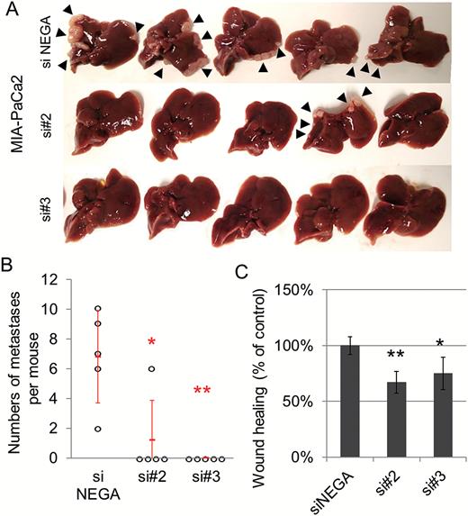 (A, B) Experimental liver metastasis model with DNA-chimeric siRNA treatment. The mice were given splenic injections of MIA-PaCa2 cells and treated with DNA-chimeric siRNA-loaded PIC 3 times per week for 1 month. After 2 months of cell injection, the livers were removed and the number of liver metastases was estimated. All livers (A)and the number of liver metastases (B) are shown. Error bars in the graph represent the mean ± SD of the mice (n = 5 per group). **P < 0.01, *P < 0.02. (C) Wound healing assay using DNA-chimeric siRNA–treated cells. **P < 0.01, *P < 0.05. Error bars represent the mean ± SD of triplicate samples.