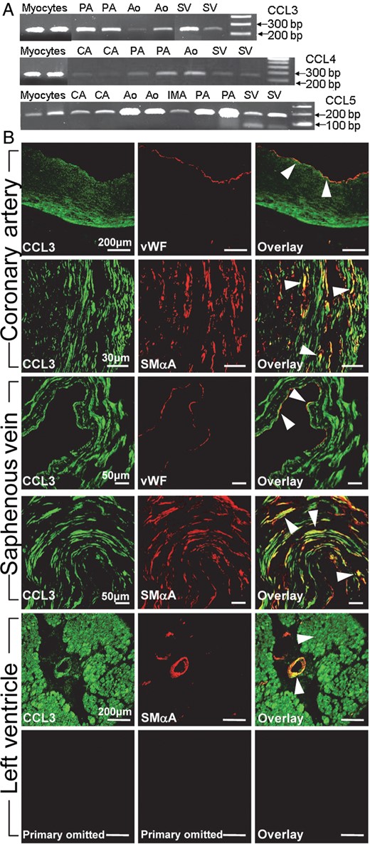 Expression of CCR5 ligands in human cardiovascular tissues. (A) Transcripts for CCL3, CCL4, and CCL5 in myocytes, aorta (Ao), pulmonary (PA), coronary (CA), and mammary (IMA) artery and saphenous vein (SV). Ladders are 100 bp. (B) Expression of CCL3 immunoreactivity (green) co-localized (orange/yellow in overlay) with vWF and SMαA (red) in coronary artery, saphenous vein and to a small intramyocardial vessel and surrounding myocardium in the left ventricle. CCR5 immunoreactivity was absent on omission of primary antibody.